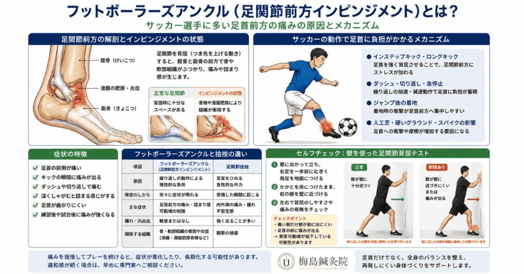 フットボーラーズアンクル（足関節前方インピンジメント）と足関節捻挫の違いを比較した図